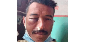 प्रहरी निरीक्षकबाट निर्घात कुटिए प्रहरी हवल्दार